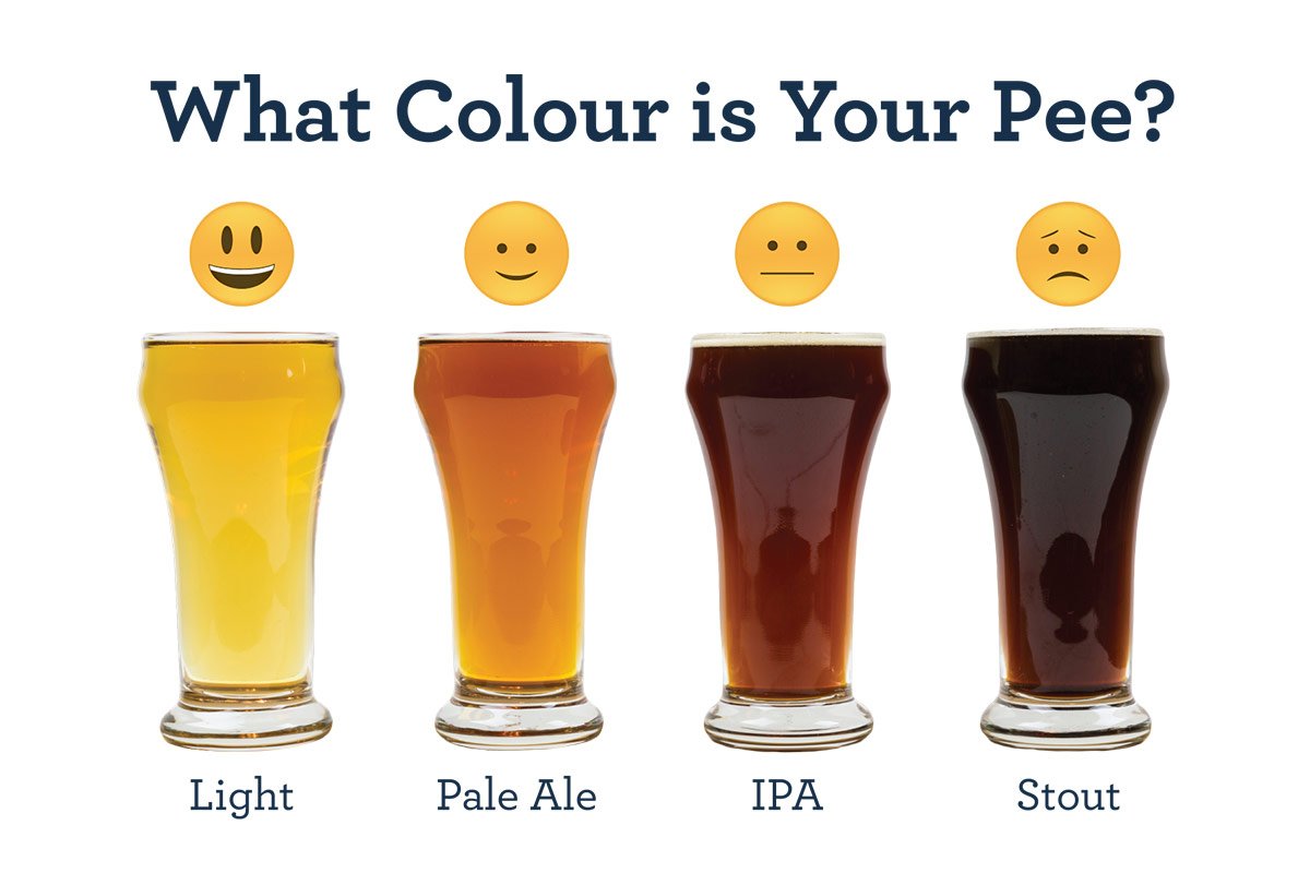 Comparison of your pee colour to beer type. Lager is healthy! Stout, see a doctor!