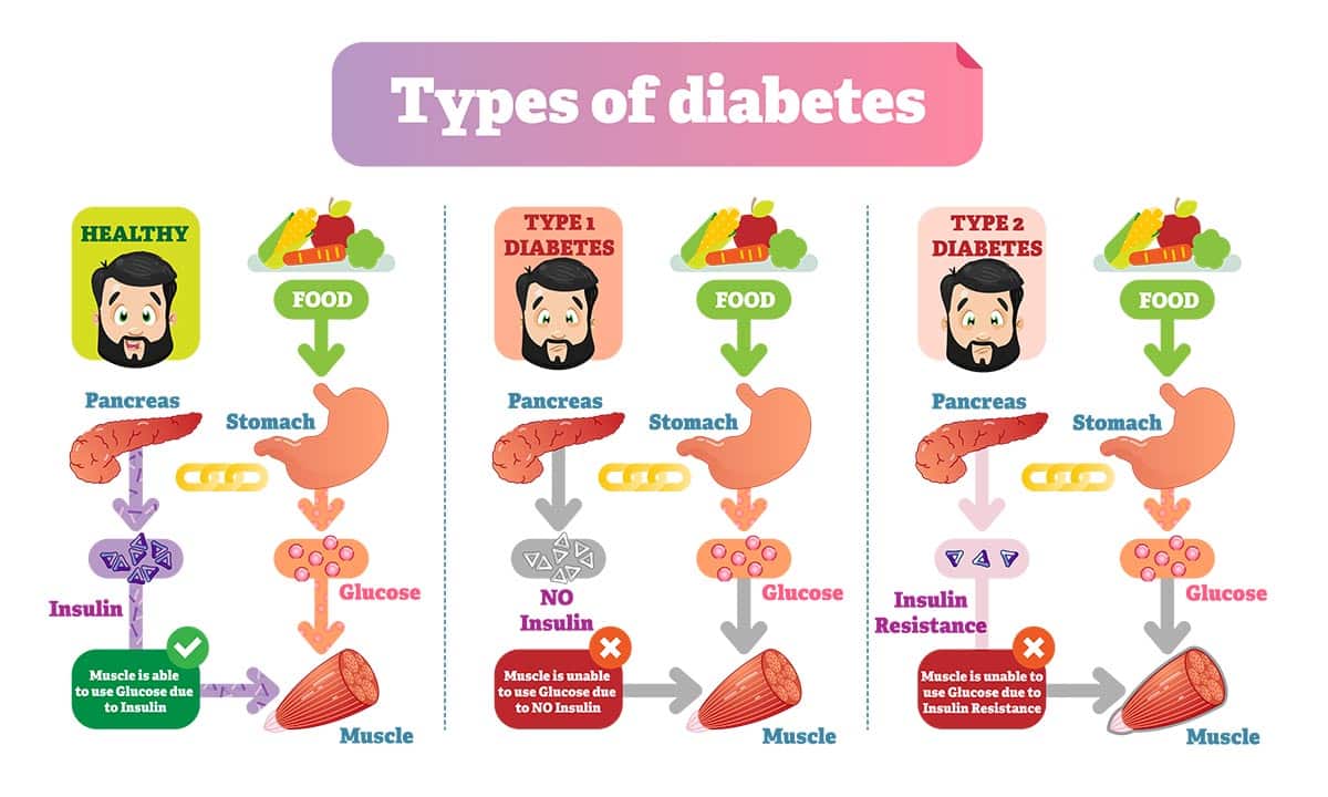 can-you-prevent-type-2-diabetes